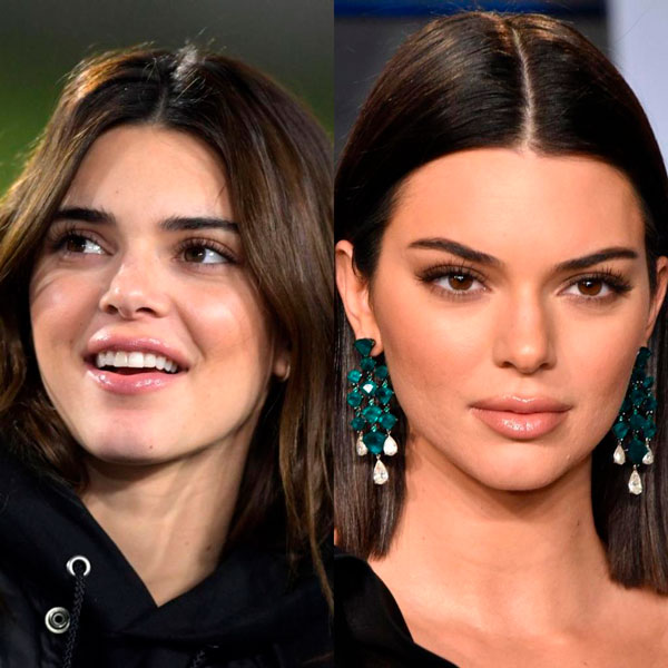 El antes y el despues de la modelo, Kendall Jenner